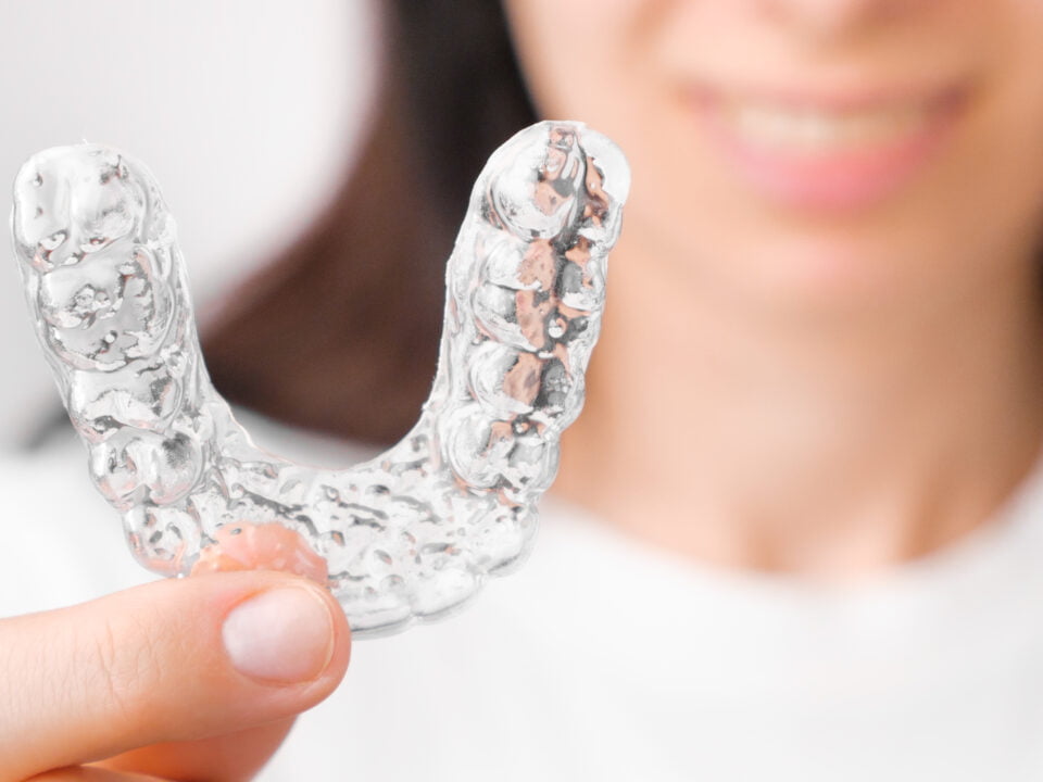 Invisalign