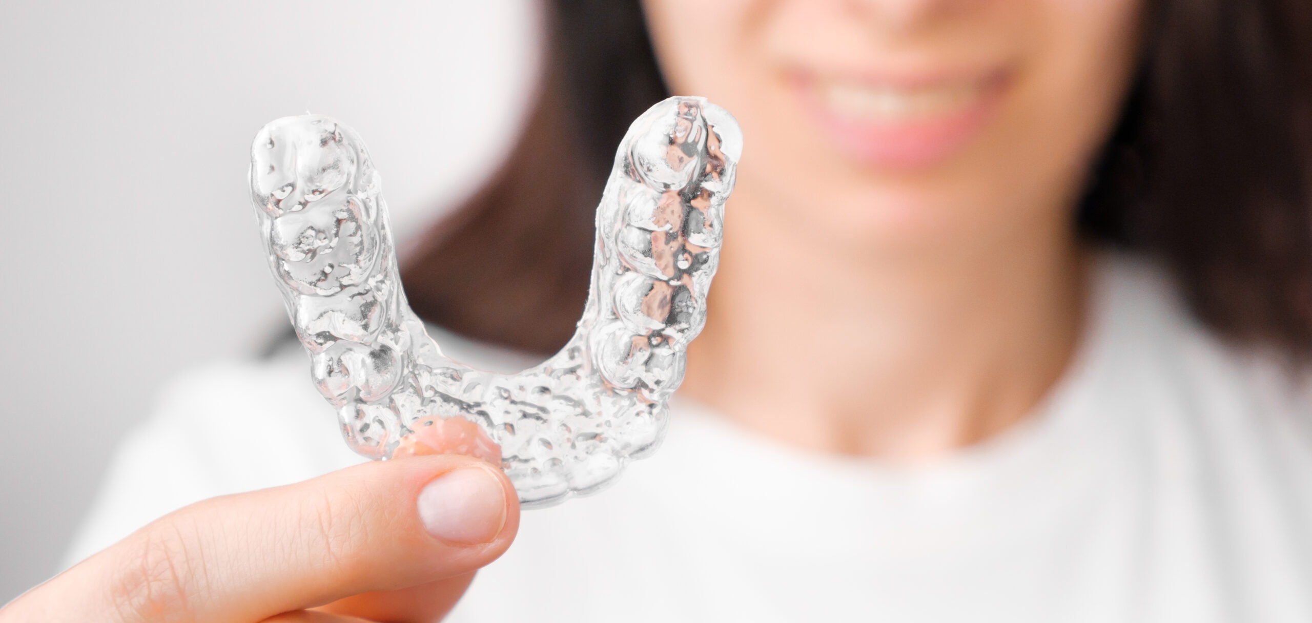 Tudo que você precisa saber sobre Invisalign